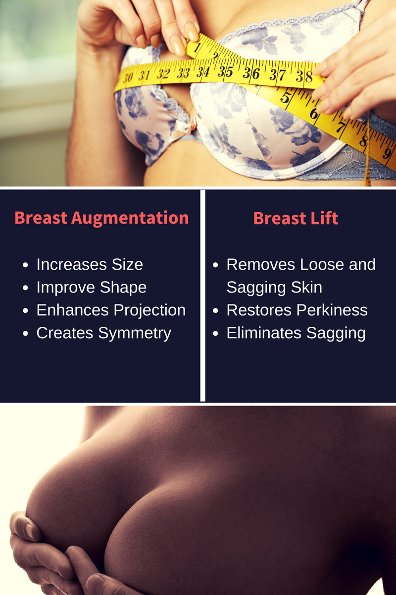 I set up a fundraising page for a breast implants because I hate my saggy  boobs