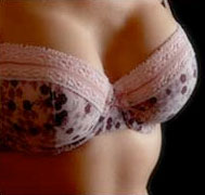 Best Age For Breast Reduction